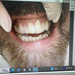 A Belmont Dental Care - Before photo