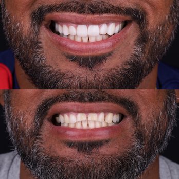 VINO Smiles Dentistry - General Dentistry Near Me - Campbell, California