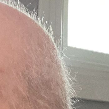 Kay-Mar Barbers - Head of hair growing back from chemo - Barbers Near Me - Orange, California Kay-Mar Barbers - Head of hair growing back from chemo - Barbers Near Me - Orange, California