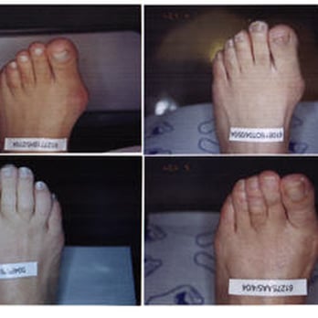 Accent On Feet - Podiatrists Near Me - Toronto, Ontario Accent On Feet - Podiatrists Near Me - Toronto, Ontario