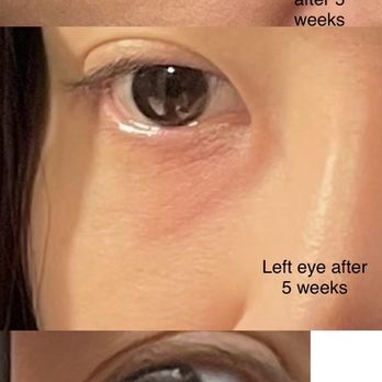 MD Laser and Cosmetics - Medical Spas Near Me - San Mateo, California MD Laser and Cosmetics - Medical Spas Near Me - San Mateo, California