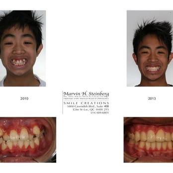 Marvin Steinberg - Smile Creation - SOURIRES-SMILES - Orthodontists Near Me - Montreal, Quebec Marvin Steinberg - Smile Creation - SOURIRES-SMILES - Orthodontists Near Me - Montreal, Quebec