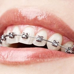 A Center For Family Dentistry - Keith Kelley, DDS
