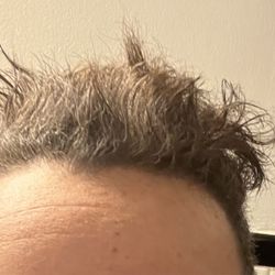 After