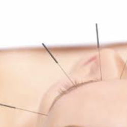 Life & Nature Acupuncture Holistic Medicine - Life and Nature uses balancing acupuncture methods that have been selected from traditional acupuncture methods and developed by us.