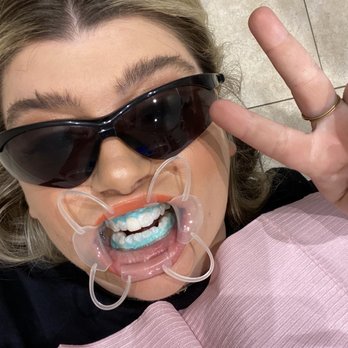Popup Smiles - Professional Teeth Whitening - Cosmetic Dentists Near Me - Newport Beach, California