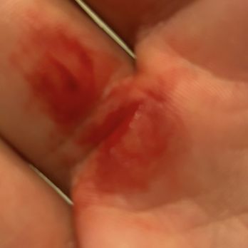 Greenhouse Juice Co. - A big slit in my finger - Juice Bars & Smoothies Near Me - Toronto, Ontario