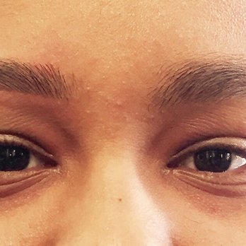 Priya Esthetics - Before and after - Skin Care Near Me - Herndon, Virginia Priya Esthetics - Before and after - Skin Care Near Me - Herndon, Virginia