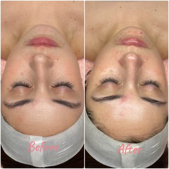RoyalT Esthetics - Refreshing Facial to maintain the skin. Great for sensitive or dry skin. - Skin Care Near Me RoyalT Esthetics - Refreshing Facial to maintain the skin. Great for sensitive or dry skin. - Skin Care Near Me