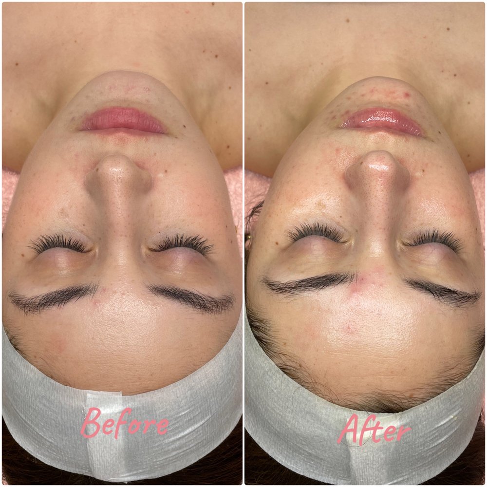 RoyalT Esthetics Logo
