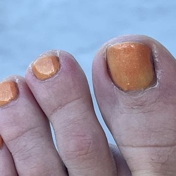 Honey Nails Salon - Ugly toes. Less than 1 week after service. - Nail Salons Near Me - Brooklyn, New York Honey Nails Salon - Ugly toes. Less than 1 week after service. - Nail Salons Near Me - Brooklyn, New York