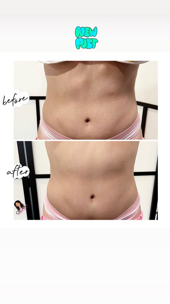 Glam Bodysculpting Logo