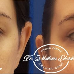 Weston Center for Plastic Surgery