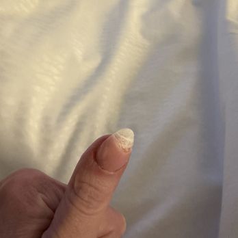 Blossom Nail - Chipped nail in 2 days! - Nail Salons Near Me - Parrish, Florida