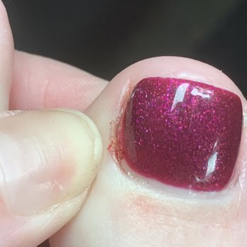 Crystal Nail Spa - The cut on my big toe - Nail Salons Near Me - Saint Petersburg, Florida