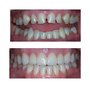 Scottsdale Cosmetic Dentistry