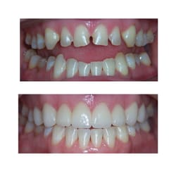 Scottsdale Cosmetic Dentistry - Before and After
