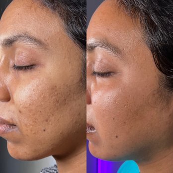 Sheila Marie Aesthetics - Eyelash Service Near Me - San Mateo, California Sheila Marie Aesthetics - Eyelash Service Near Me - San Mateo, California