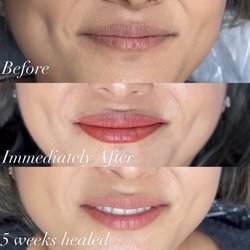 Hailey's IBeauty - Lip blush