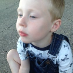 Little Keepers - This is the bruise that showed up on my son's cheek a few days after he told me he had been smacked at Little Keepers Drop-In Child Care.