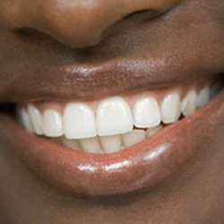 Narbonne Family Dentist