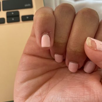 Elite Spa Nails - The cut after 5 days and polish already gone - Nail Salons Near Me - Burlington, North Carolina