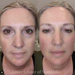 Laser Center of Southlake