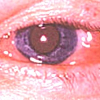 Master Eye  - We treat eye disease!  Diagnosed & treated at Master Eye. - Optometrists Near Me - Austin, Texas