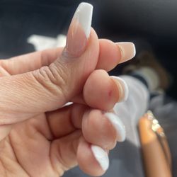 Ivy Nails & Lash - Blood under nail from filing no ointment treatment