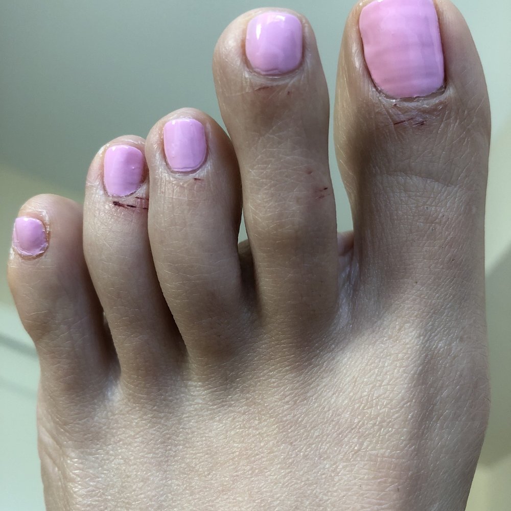 Glamicure - Technician cut my toes with her tools during pedicure. Painful! - Nail Salons Near Me - Los Angeles, California Glamicure - Technician cut my toes with her tools during pedicure. Painful! - Nail Salons Near Me - Los Angeles, California
