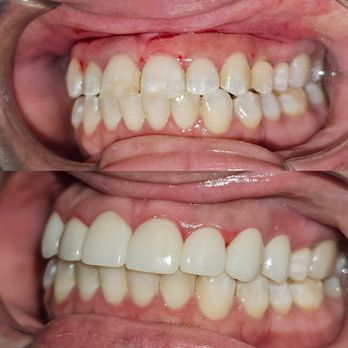 Amazing Dental - General Dentistry Near Me - Arlington, Texas Amazing Dental - General Dentistry Near Me - Arlington, Texas