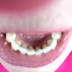 Glick Dental Associates