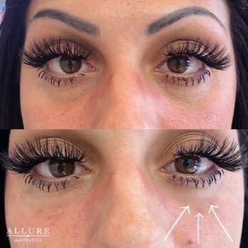 Allure Aesthetics - Medical Spas Near Me - Boca Raton, Florida