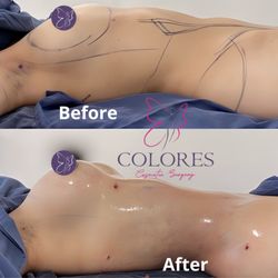 Colores Medical Cosmetic