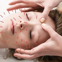 Five Elements Acupuncture