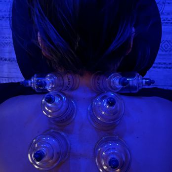 Innate Bodywork - Look at this awesome cupping work! - Massage Therapy Near Me - Sherman Oaks, California Innate Bodywork - Look at this awesome cupping work! - Massage Therapy Near Me - Sherman Oaks, California