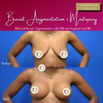 Georgia Plastic & Reconstructive Surgery - Cosmetic Surgeons Near Me - Marietta, Georgia