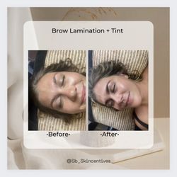 SB Skincentives