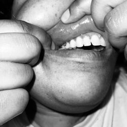OrthoWorks - Hercules - They left brackets on my teeth. Mind you I paid them in full.