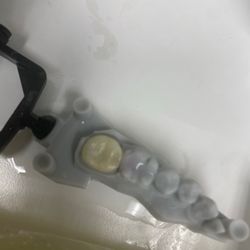 Shawn Lottier, DDS - Second wrong crown receive but still wanted to adjust it and put it in.