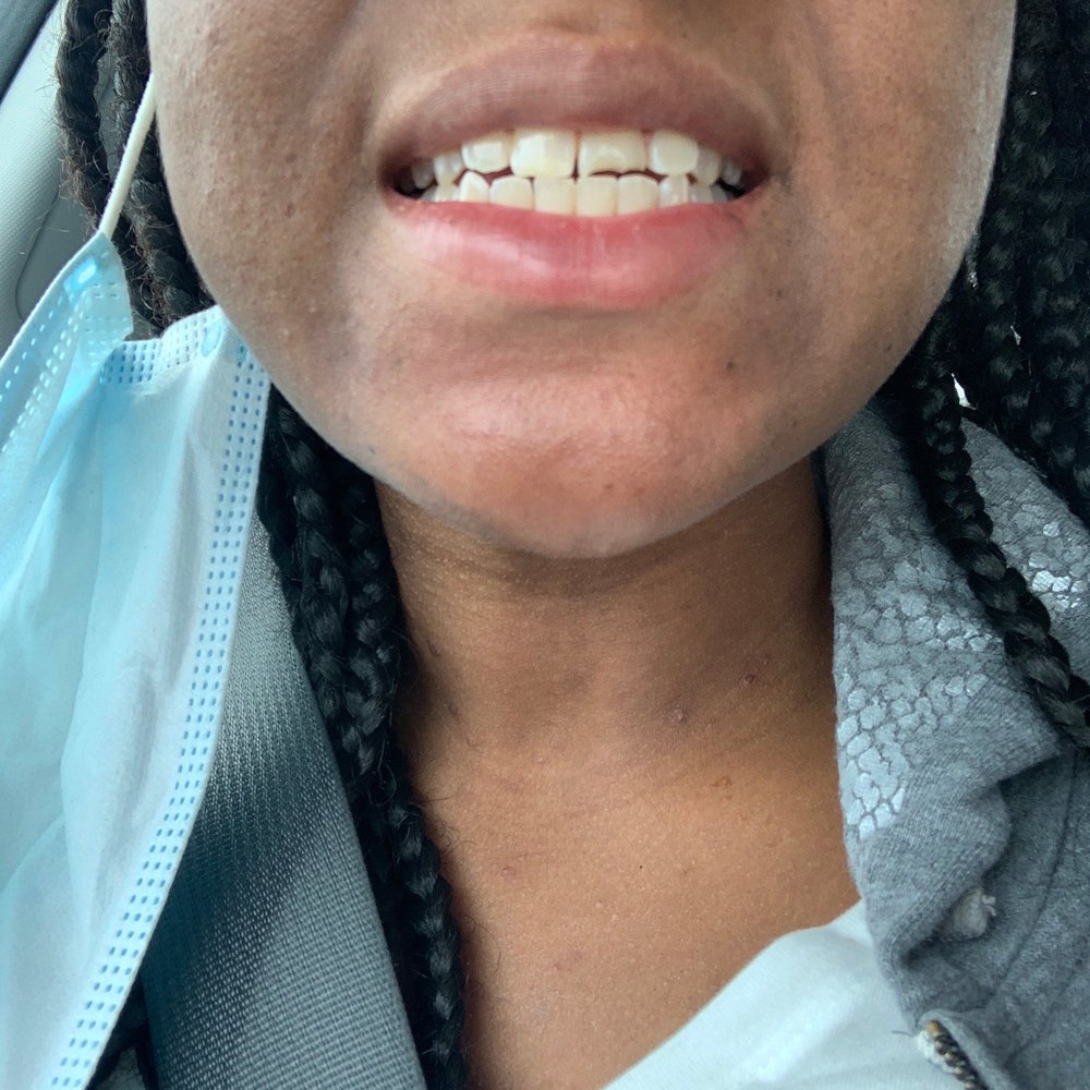 Aspen Dental - Phoenix, AZ - Arcadia - Oral Surgeons Near Me - Phoenix, Arizona Aspen Dental - Phoenix, AZ - Arcadia - Oral Surgeons Near Me - Phoenix, Arizona