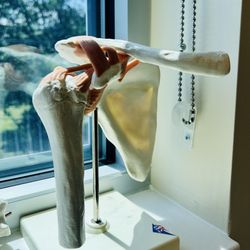 Orthopedic Associates Of Dutchess County - Shoulder joint model