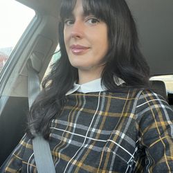 Aesthetic Solutions - Right after my appointment, almost no bruising. Just a radiant glow!