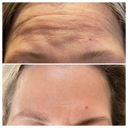 Skinpedia & Co - Before & after
