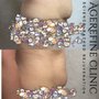AgeRefine Clinic