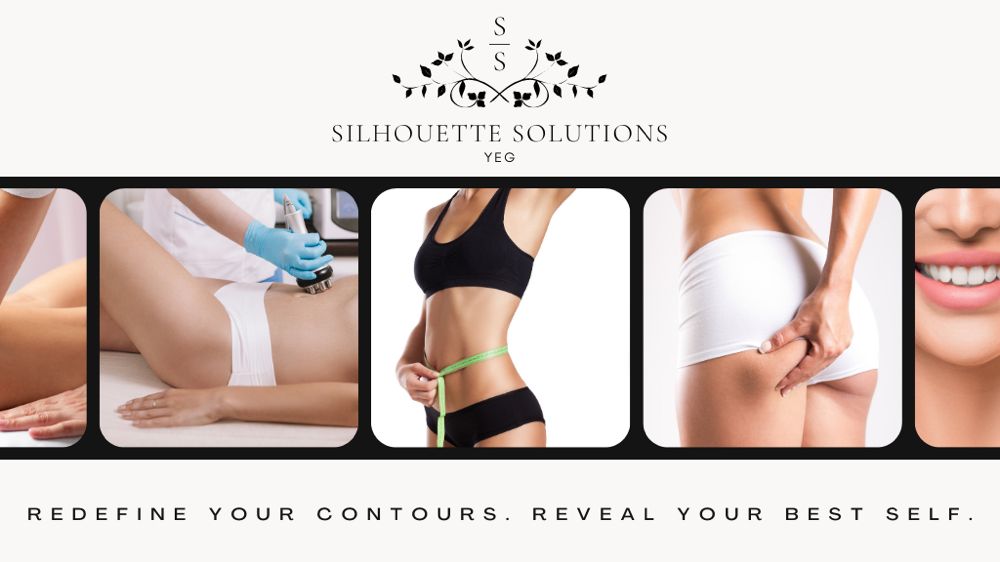 Silhouette Solutions YEG Logo