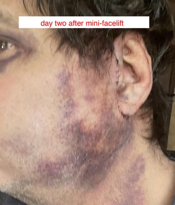 Baroody Plastic Surgery by null