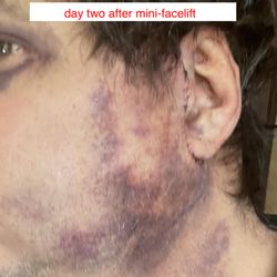 Michael Baroody, MD - Day Two