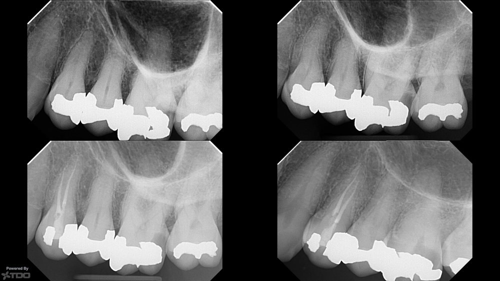 LAKE WASHINGTON ENDODONTICS Updated September 2024 22 Photos