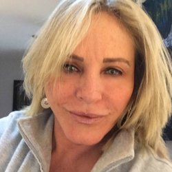 Mary Powers, MD FACS - After the magic.